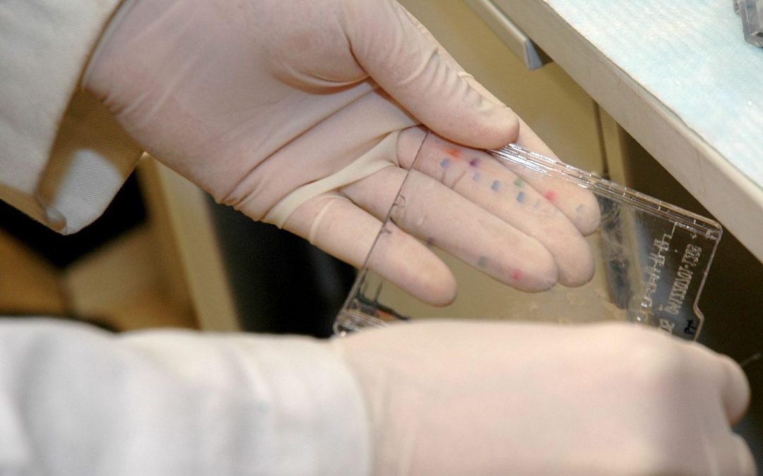 western blotting technique