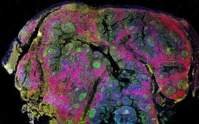 Multiparameter Fluorescence Imaging