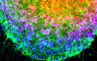 Expansion Microscopy