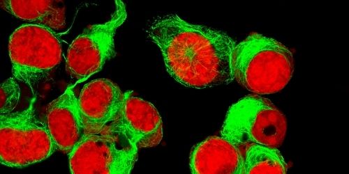 Single Cell Analysis in Immunology
