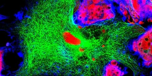 confocal miscroscopy