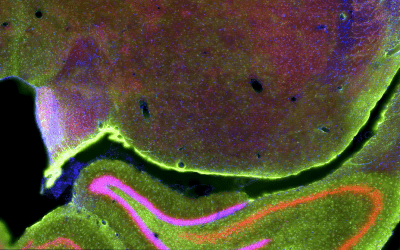 Steric Effects in Multiplexed Immunofluorescence