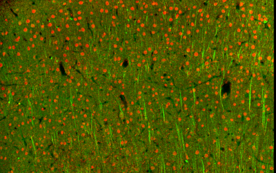 Newsletter: Confocal Microscopy and Related Technologies