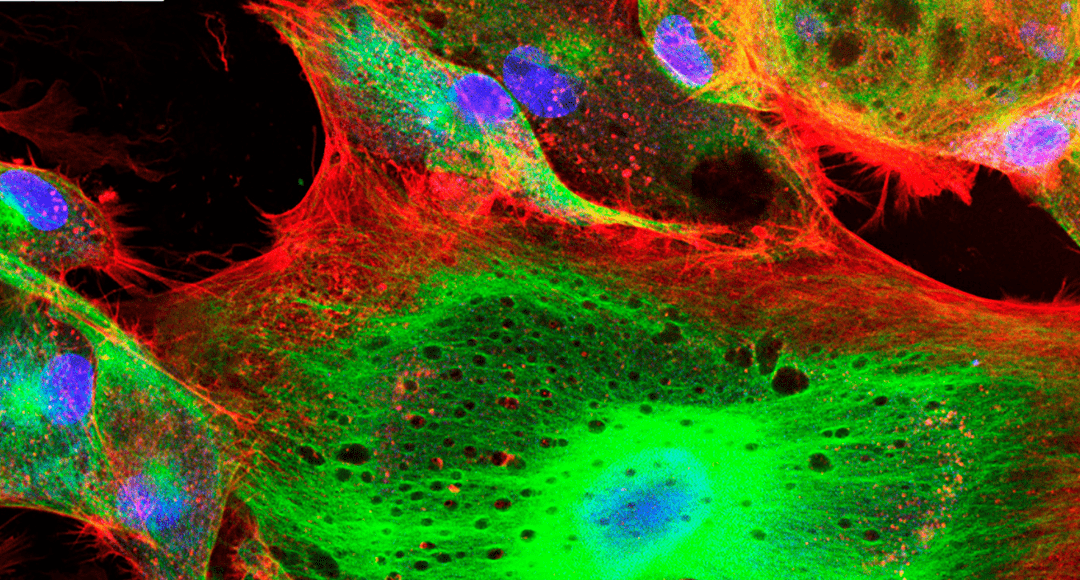 The Discovery and Evolution of Fluorescent Proteins