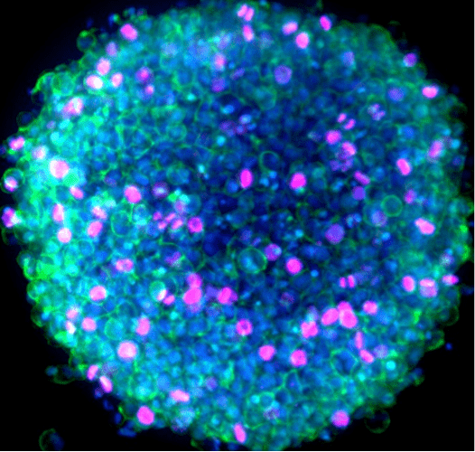 Immunofluorescence image of a HeLa spheroid captured with the CellInsight CX7 LZR Pro. 