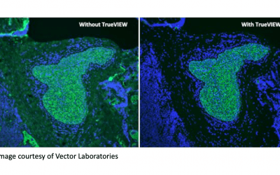 Tips to Minimize Autofluorescence
