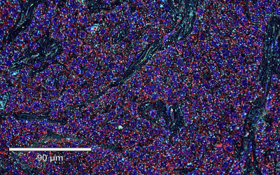 Overcoming Common Challenges with Fluorescent IHC