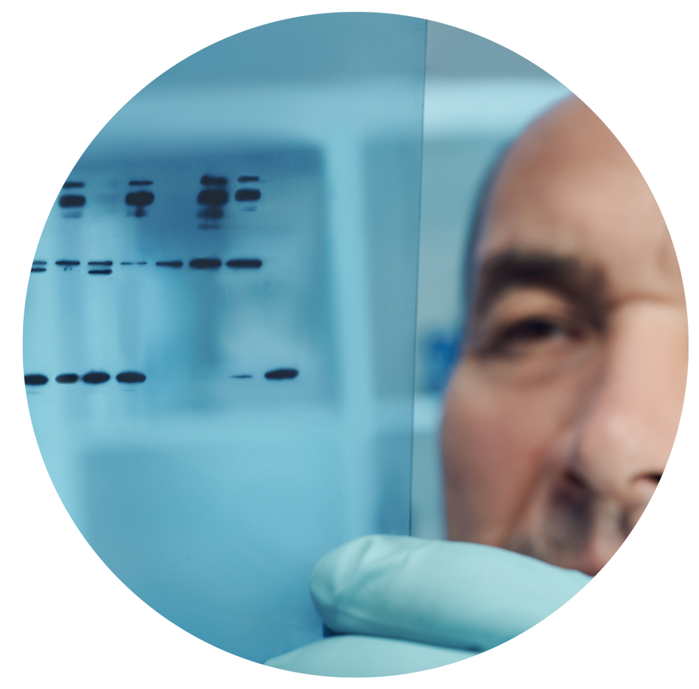 close up of man, western blotting example  close up of man, western blotting example